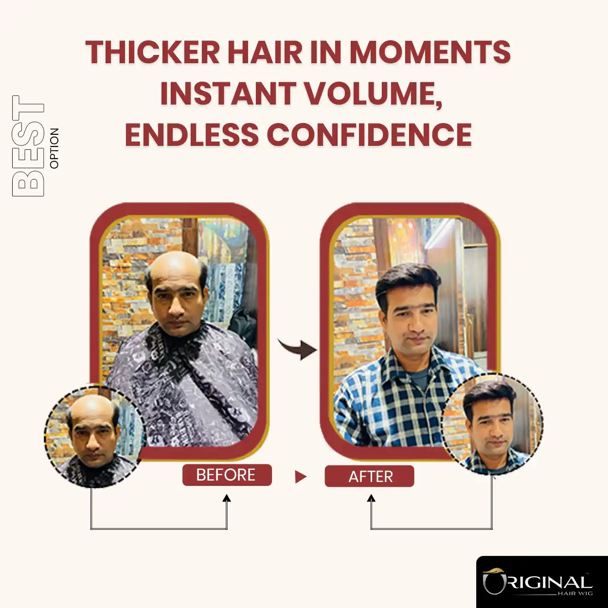 Australian Mirage Hair Patch Skin Based Top Natural Scalp Look